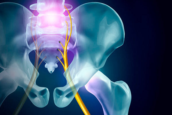 Si padeces del nervio ciático te conviene leer ésto